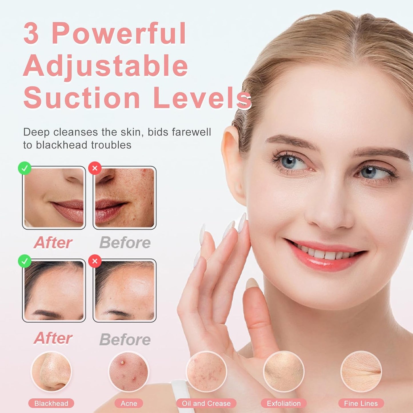 LummiGlow Pore Refine Vacuum – Blackhead Remover